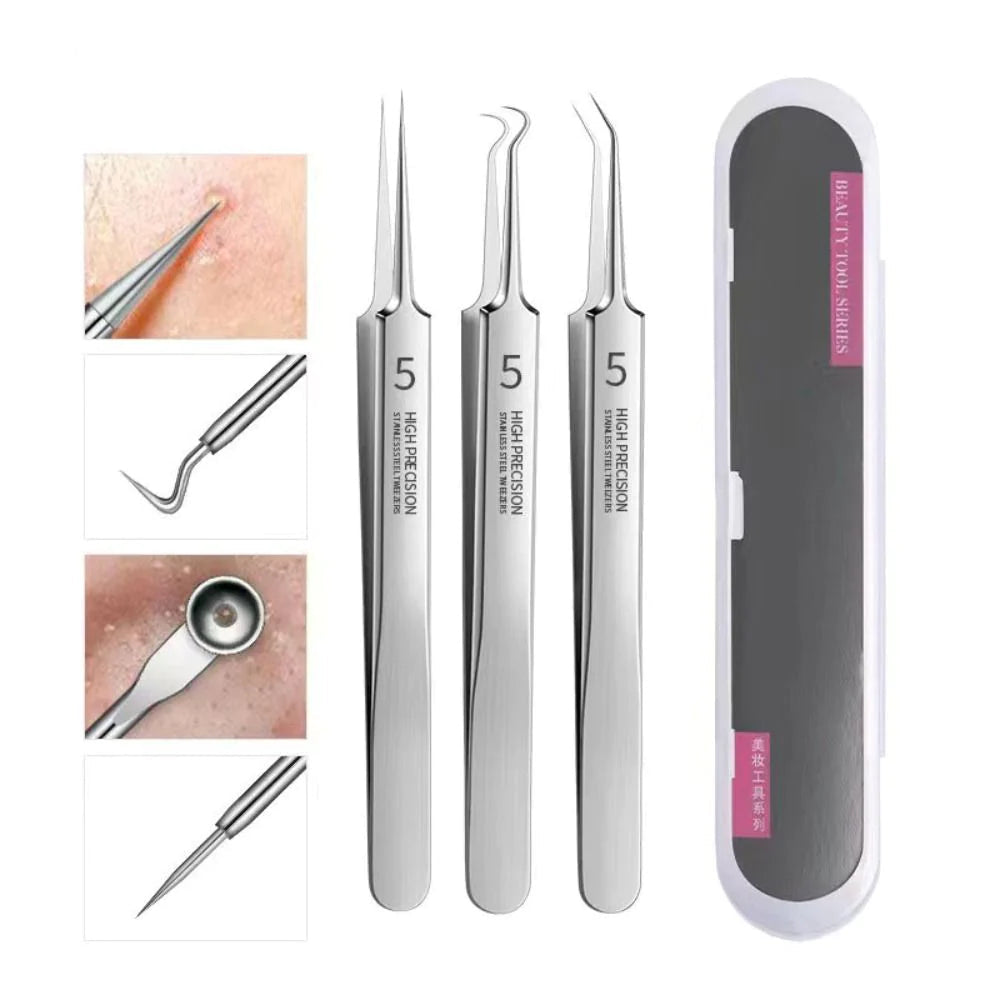 Blackheads Removal Kit (60% OFF TODAY!)