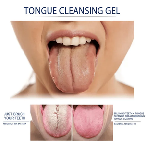 Probiotic Tongue Cleaning Gel Set [Gel + Scraper] - (60% OFF TODAY!)