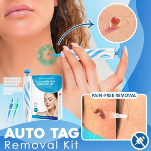 Fast Auto Tag Removal Kit (60% OFF TODAY!)