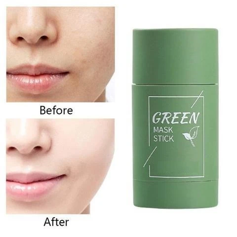 GREEN TEA BLACKHEAD AND ACNE CLEANSING MASK (60% OFF TODAY!)