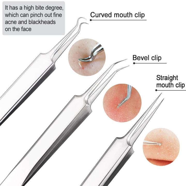 Blackheads Removal Kit (60% OFF TODAY!)